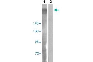 Western blot analysis of Lane 1: UV treated COS-7 cells, Lane 2: antigen-specific peptide treated COS-7 cells with IGF2R (phospho S2409) polyclonal antibody  at 1:500-1:1000 dilution. (IGF2R antibody  (pSer2409))