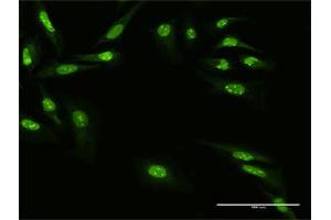 Immunofluorescence of purified MaxPab antibody to ZNF668 on HeLa cell. (ZNF668 antibody  (AA 1-619))