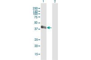 Western Blot analysis of ART3 expression in transfected 293T cell line by ART3 MaxPab polyclonal antibody. (ART3 antibody  (AA 1-378))