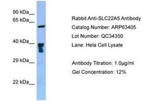 Image no. 1 for anti-Solute Carrier Family 22 Member 5 (SLC22A5) (C-Term) antibody (ABIN6749981) (SLC22A5 antibody  (C-Term))