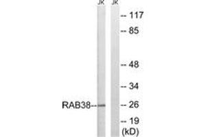 Western blot analysis of extracts from Jurkat cells, using RAB38 Antibody. (RAB38 antibody  (AA 80-129))