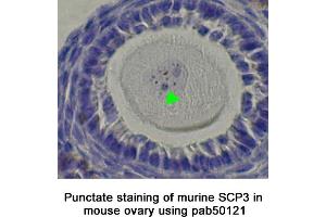 Image no. 1 for anti-Synaptonemal Complex Protein 3 (SYCP3) (C-Term) antibody (ABIN363430) (SYCP3 antibody  (C-Term))