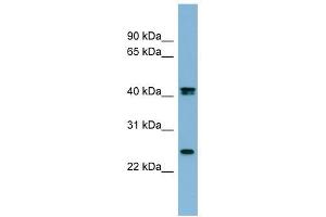 FETUB antibody used at 1 ug/ml to detect target protein. (FETUB antibody  (N-Term))