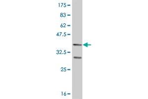 Western Blot detection against Immunogen (37. (FOXO1 antibody  (AA 452-555))