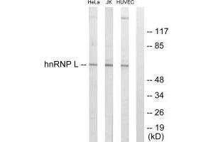 Western blot analysis of extracts from HeLa cells, Jurkat cells and HUVEC cells, using hnRNP L antibody. (HNRNPL antibody  (N-Term))