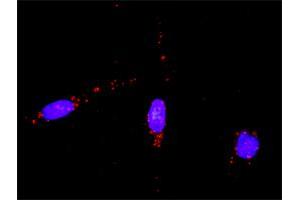 Proximity Ligation Analysis of protein-protein interactions between RAD51 and CASP3. (RAD51 antibody  (AA 1-339))