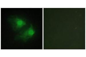 Immunofluorescence (IF) image for anti-LIM Domain Kinase 2 (LIMK2) (Internal Region) antibody (ABIN1849457) (LIMK2 antibody  (Internal Region))