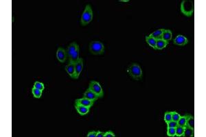 Immunofluorescent analysis of HepG2 cells using ABIN7162265 at dilution of 1:100 and Alexa Fluor 488-congugated AffiniPure Goat Anti-Rabbit IgG(H+L) (SLC51B antibody  (AA 57-128))