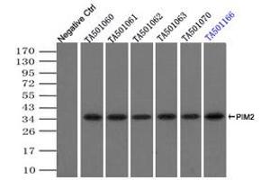 Image no. 2 for anti-Proto-Oncogene Pim-2 (Serine Threonine Kinase) (PIM2) antibody (ABIN1500220) (PIM2 antibody)