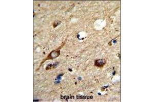 Formalin-fixed and raffin-embedded human brain tissue reacted with AGT3 Antibody (Center), which was peroxidase-conjugated to the secondary antibody, followed by DAB staining. (AGPAT3 antibody  (AA 241-269))