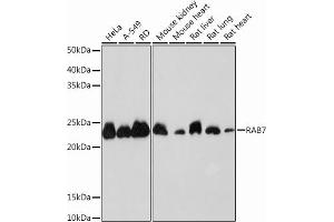 Western blot analysis of extracts of various cell lines, using R Rabbit mAb (ABIN7269812) at 1:1000 dilution. (RAB7A antibody)