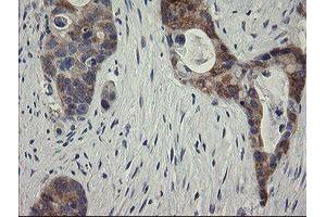 Image no. 2 for anti-RIO Kinase 2 (RIOK2) (AA 277-552) antibody (ABIN1491304) (RIOK2 antibody  (AA 277-552))