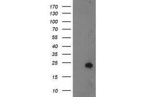 HEK293T cells were transfected with the pCMV6-ENTRY control (Left lane) or pCMV6-ENTRY FABP2 (Right lane) cDNA for 48 hrs and lysed. (FABP2 antibody)