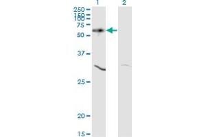 Western Blotting (WB) image for anti-V-Akt Murine Thymoma Viral Oncogene Homolog 1 (AKT1) (AA 1-481) antibody (ABIN598531) (AKT1 antibody  (AA 1-481))