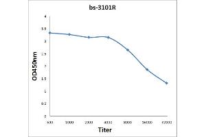 Antigen: 2 µg/100 µL  Primary: Antiserum, 1:500, 1:1000, 1:2000, 1:4000, 1:8000, 1:16000, 1:32000;  Secondary: HRP conjugated Rabbit Anti-Goat IgG at 1: 5000;  TMB staining Read the data in Microplate Reader by 450nm. (DOK2 antibody  (pTyr351))