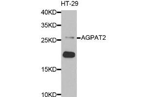 Western blot analysis of extracts of HT-29 cells, using AGPAT2 antibody (ABIN5973903) at 1/1000 dilution. (AGPAT2 antibody)