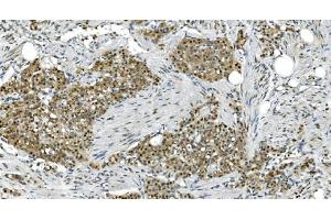 IHC analysis of LSM7 using anti-LSM7 antibody (ABIN7598937). (LSM7 antibody  (AA 1-103))