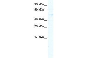 WB Suggested Anti-ARX Antibody Titration:  5. (Arx antibody  (Middle Region))