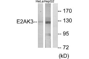 Western blot analysis of extracts from HeLa cells and HepG2 cells, using E2AK3 antibody.