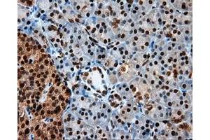 Immunohistochemical staining of paraffin-embedded colon tissue using anti-LTA4H mouse monoclonal antibody. (LTA4H antibody)