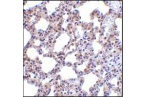 Immunohistochemistry of PKR in rat lung tissue with this product at 5 μg/ml.