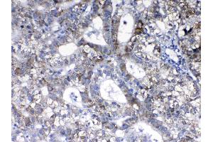 IHC analysis of ErbB 2 using anti- ErbB 2 antibody . (ErbB2/Her2 antibody  (N-Term))
