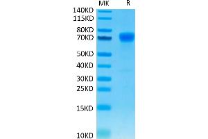 Human PD-L1 on Tris-Bis PAGE under reduced condition. (PD-L1 Protein (AA 19-238) (mFc Tag))