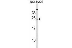 Western Blotting (WB) image for anti-CD300c (CD300C) antibody (ABIN2999034)