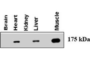 Western blot using AGL polyclonal antibody  at 1 : 500 dilution . (AGL antibody  (AA 1479-1510))