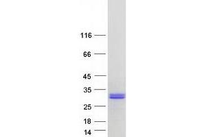 Validation with Western Blot