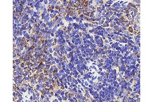 Immunohistochemistry analysis of paraffin-embedded rat thymus tissue using INPP5D Polyclonal Antibody at dilution of 1:300. (INPP5D antibody)