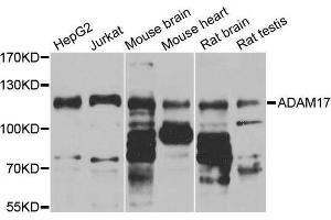 Western Blotting (WB) image for anti-ADAM Metallopeptidase Domain 17 (ADAM17) (C-Term) antibody (ABIN5663782) (ADAM17 antibody  (C-Term))