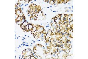 Immunohistochemistry of paraffin-embedded human stomach using CTNNA1 antibody. (CTNNA1 antibody  (AA 637-906))
