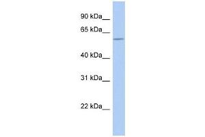 GOPC antibody used at 1 ug/ml to detect target protein. (GOPC antibody  (N-Term))