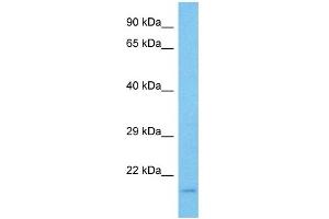 Host:  Mouse  Target Name:  MXI1  Sample Tissue:  Mouse Testis  Antibody Dilution:  1ug/ml (MXI1 antibody  (Middle Region))