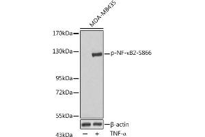 Western blot analysis of extracts of MDA-MB435 cells, using Phospho-NF-κB2-S866 antibody (ABIN3020402, ABIN3020403, ABIN3020404, ABIN1681895 and ABIN7101874) at dilution. (NFKB2 antibody  (pSer866))