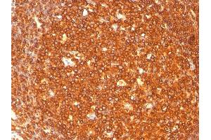 Formalin-fixed, paraffin-embedded human Tonsil stained with HLA-DR Monoclonal Antibody (SPM289). (HLA-DR antibody)