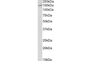 ABIN5539540 (1µg/ml) staining of HeLa nuclear lysate (35µg protein in RIPA buffer). (HDAC6 antibody  (C-Term))