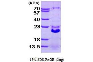 SDS-PAGE (SDS) image for Heat Shock 27kDa Protein Family, Member 7 (Cardiovascular) (HSPB7) (AA 1-170) protein (His tag) (ABIN667773)