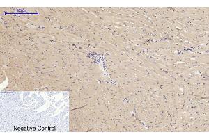 anti-Matrix Metalloproteinase 2 (MMP2) (AA 580-660) antibody