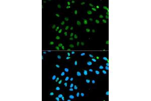 Immunofluorescence analysis of MCF7 cell using MNAT1 antibody. (MNAT1 antibody  (AA 1-309))