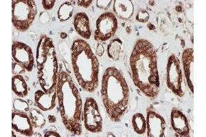 Immunohistochemical staining of paraffin-embedded Human Kidney tissue using anti-SCFD1 mouse monoclonal antibody. (SCFD1 antibody)