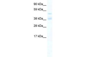 Western Blotting (WB) image for anti-Zinc Finger Protein 17 (ZNF17) antibody (ABIN2461332) (ZNF17 antibody)