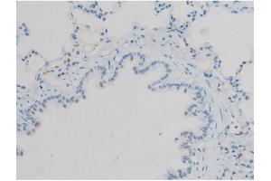 ABIN6267410 at 1/200 staining Rat lung tissue sections by IHC-P. (Connexin 43/GJA1 antibody  (pSer368))