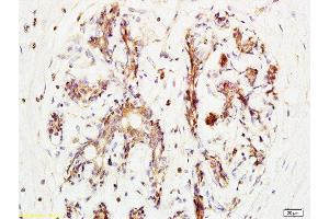 Immunohistochemistry (Paraffin-embedded Sections) (IHC (p)) image for anti-Breast Cancer Metastasis-Suppressor 1-Like (BRMS1L) (AA 151-246) antibody (ABIN730933)