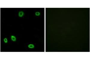 Immunofluorescence analysis of HuvEc cells, using OR5L1/2 Antibody.