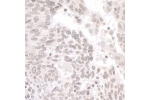Immunohistochemistry (IHC) image for anti-Partner and Localizer of BRCA2 (PALB2) (AA 675-725) antibody (ABIN7454733) (PALB2 antibody  (AA 675-725))