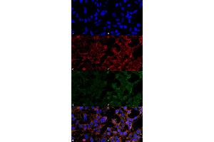 Immunocytochemistry/Immunofluorescence analysis using Mouse Anti-4-Hydroxynonenal Monoclonal Antibody, Clone 12F7 . (HNE antibody)