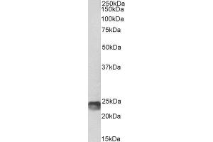 Biotinylated ABIN4902767 (1µg/ml) staining of Mouse Spleen lysate (35µg protein in RIPA buffer), exactly mirroring its parental non-biotinylated product. (SOCS1 antibody  (C-Term) (Biotin))