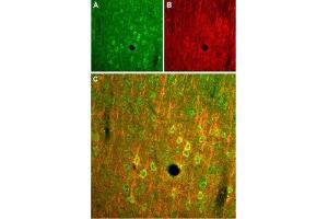 Expression of NMDA receptor 2B in rat cortex - Immunohistochemical staining of rat parietal cortex frozen sections stained with Anti-NMDAR2B (GluN2B) (extracellular) Antibody (ABIN7043230, ABIN7044326 and ABIN7044327), (1:100). (GRIN2B antibody  (Extracellular))